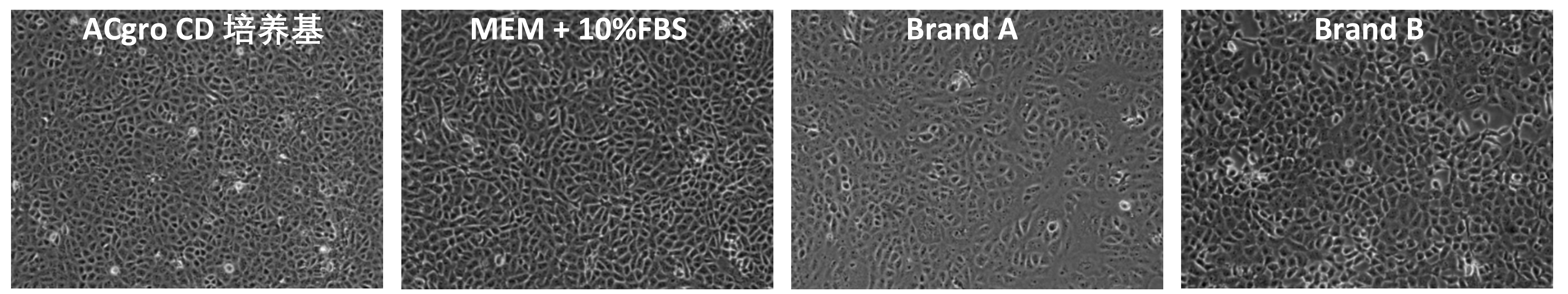 ACgro CD培养基中培养的Vero细胞轮廓